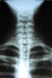 Normal X-Ray